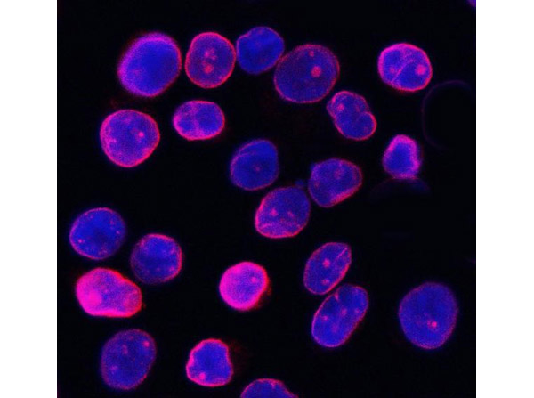 Immunofluorescence analysis of Lamin B1